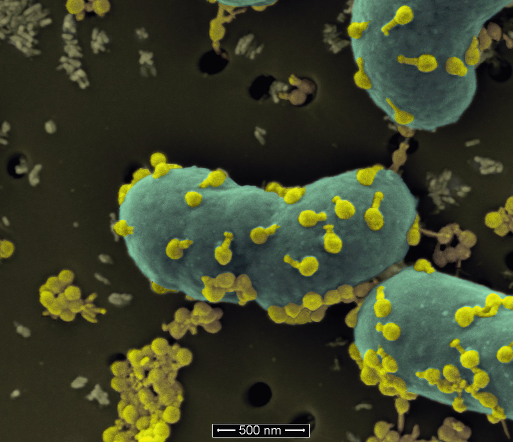 The Art of Killing a Superbug