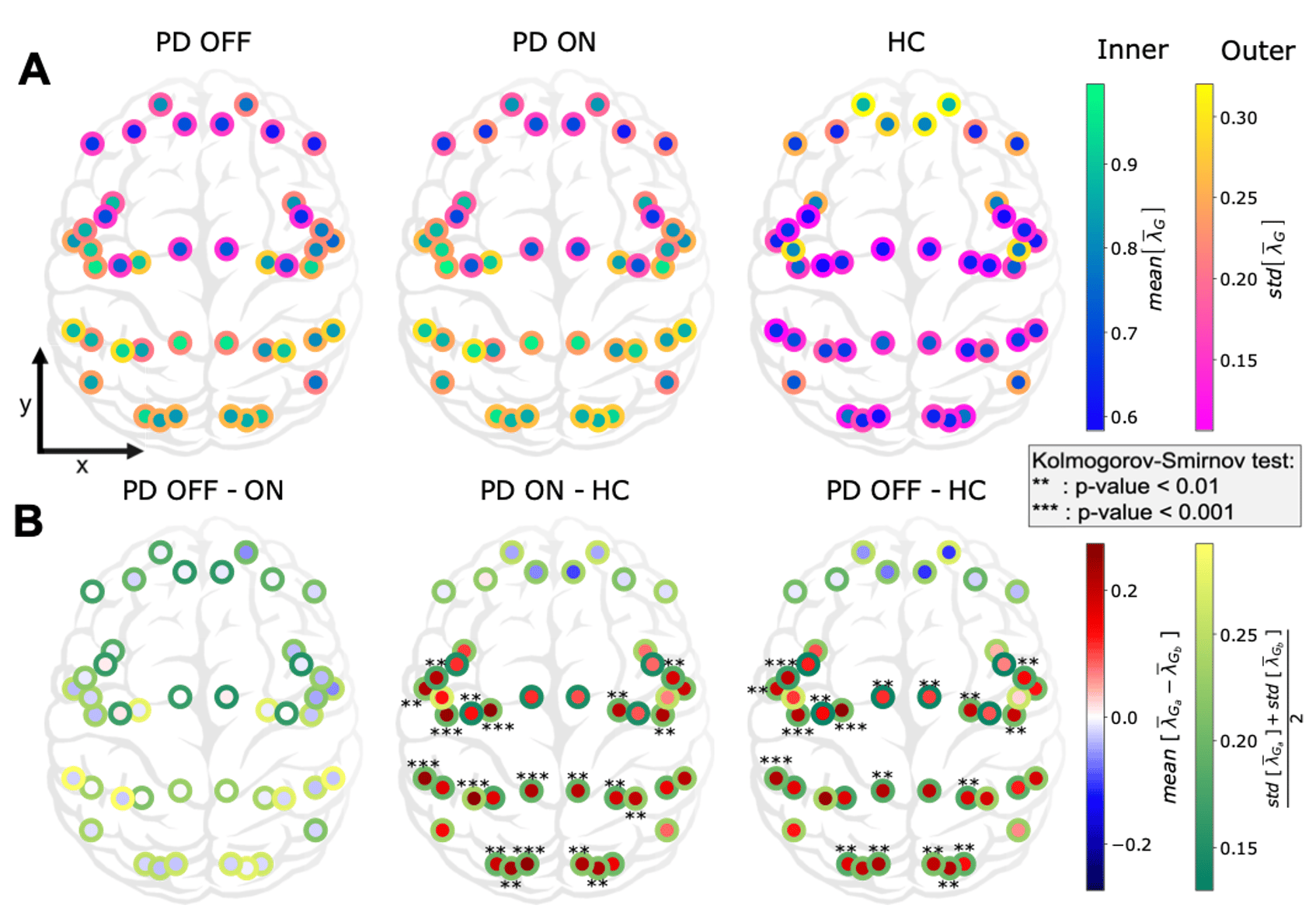 Cortex-wide excitation/inhibition topography in Parkinson’s disease 