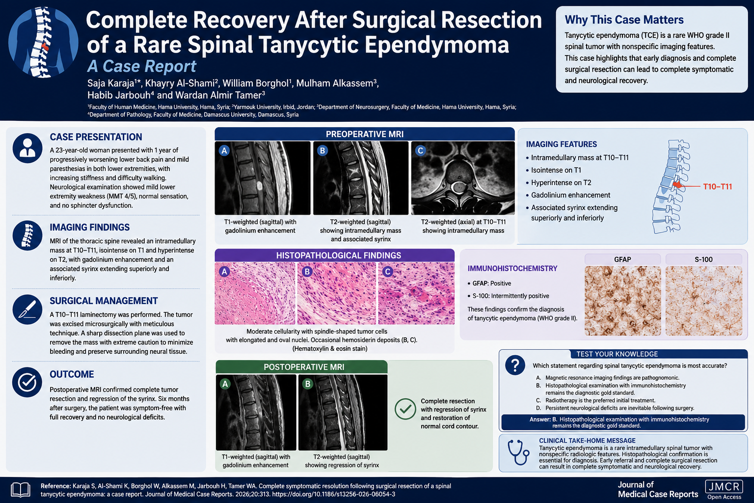 Complete Recovery After Surgical Resection of a Rare Spinal Tanycytic Ependymoma