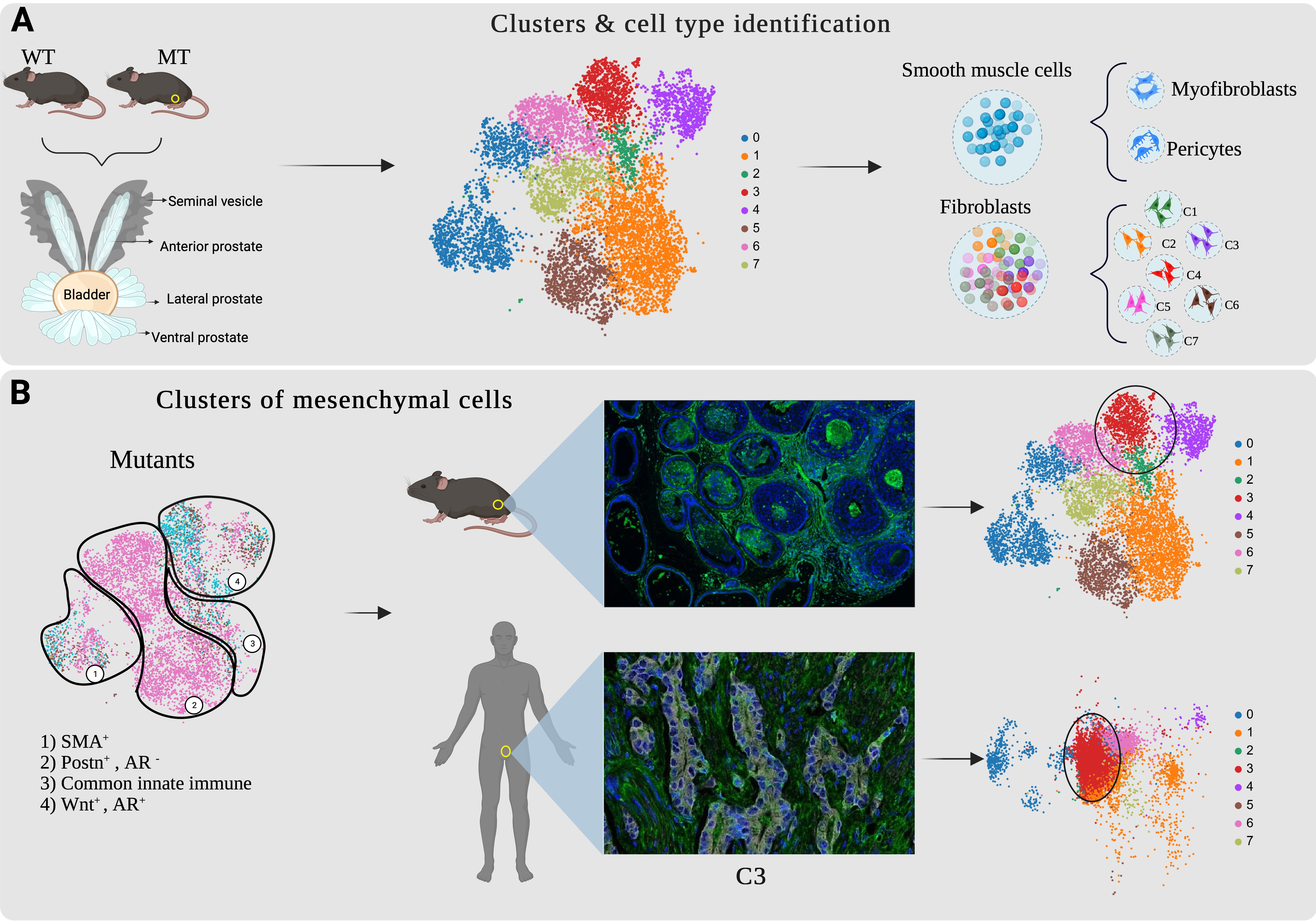 Diving into How the Stromal Microenvironment Supports Prostate Cancer Growth and Metastasis