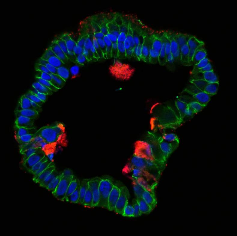 Chlamydia in human organoids and the origin of fallopian tube disease