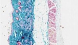 npj Microgravity Article: Skin physiology in microgravity: a 3-month stay aboard ISS induces dermal atrophy and affects cutaneous muscle and hair follicles cycling in mice