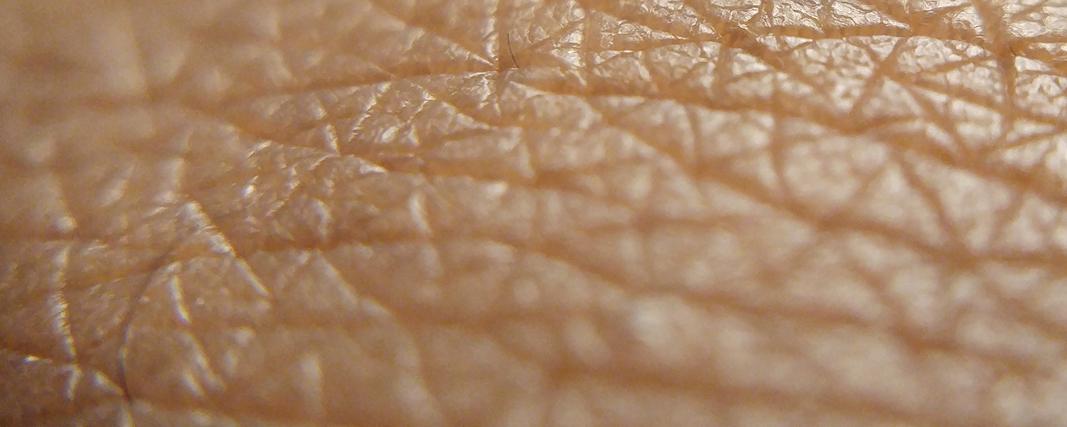 #InMice - but on human skin: colonisation and clearance of S. aureus