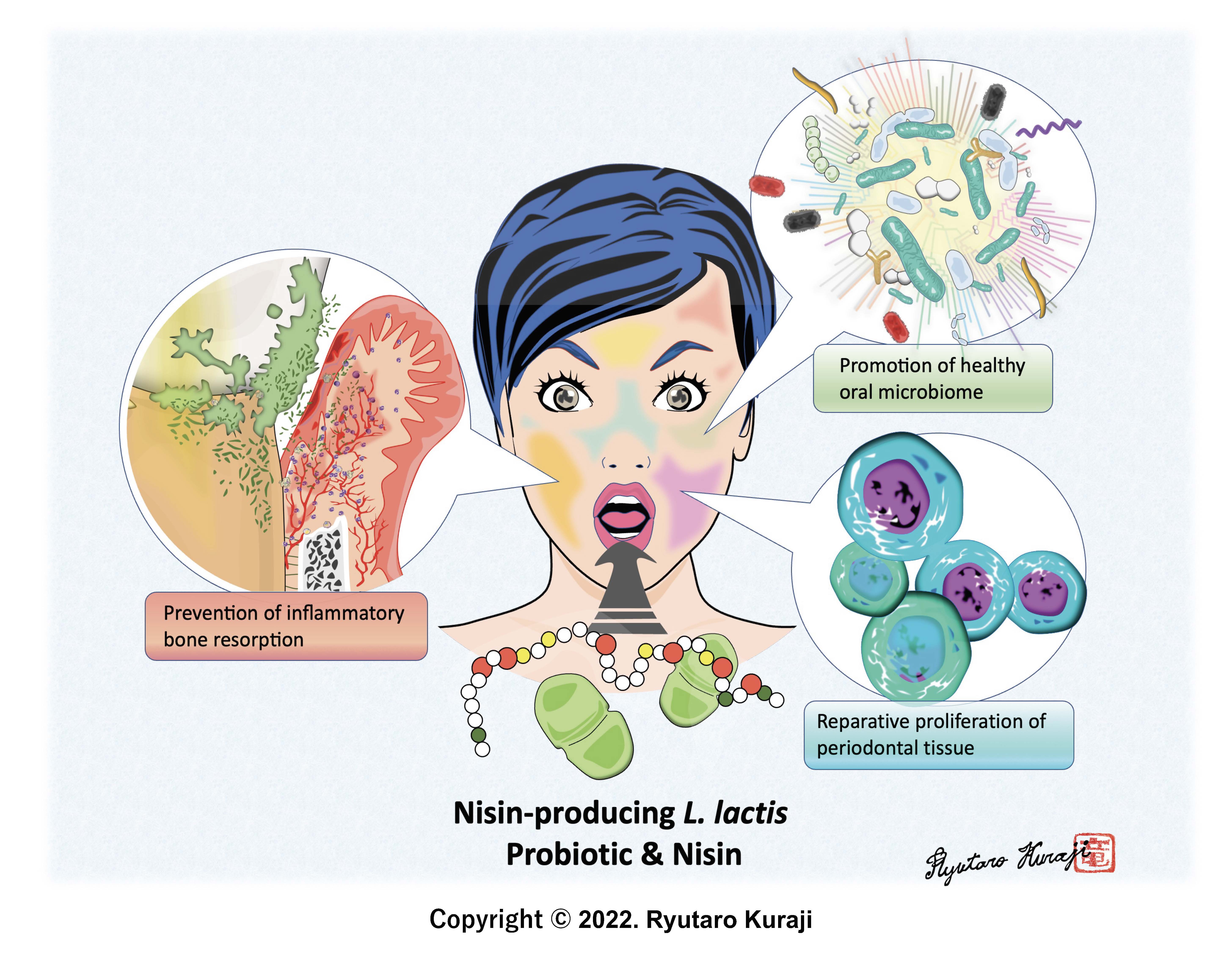 The Many Healing Faces of Nisin  - Nisin and its Probiotic Prevent Inflammatory Bone Loss while Promoting Reparative Proliferation and a Healthy Microbiome    
