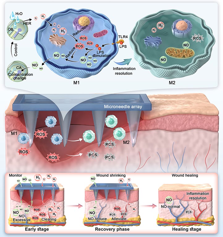 Closed‑Loop Synergistic Nitric Oxide/Hydrogen Delivery with Feedback Control for Diabetic Wound Healing