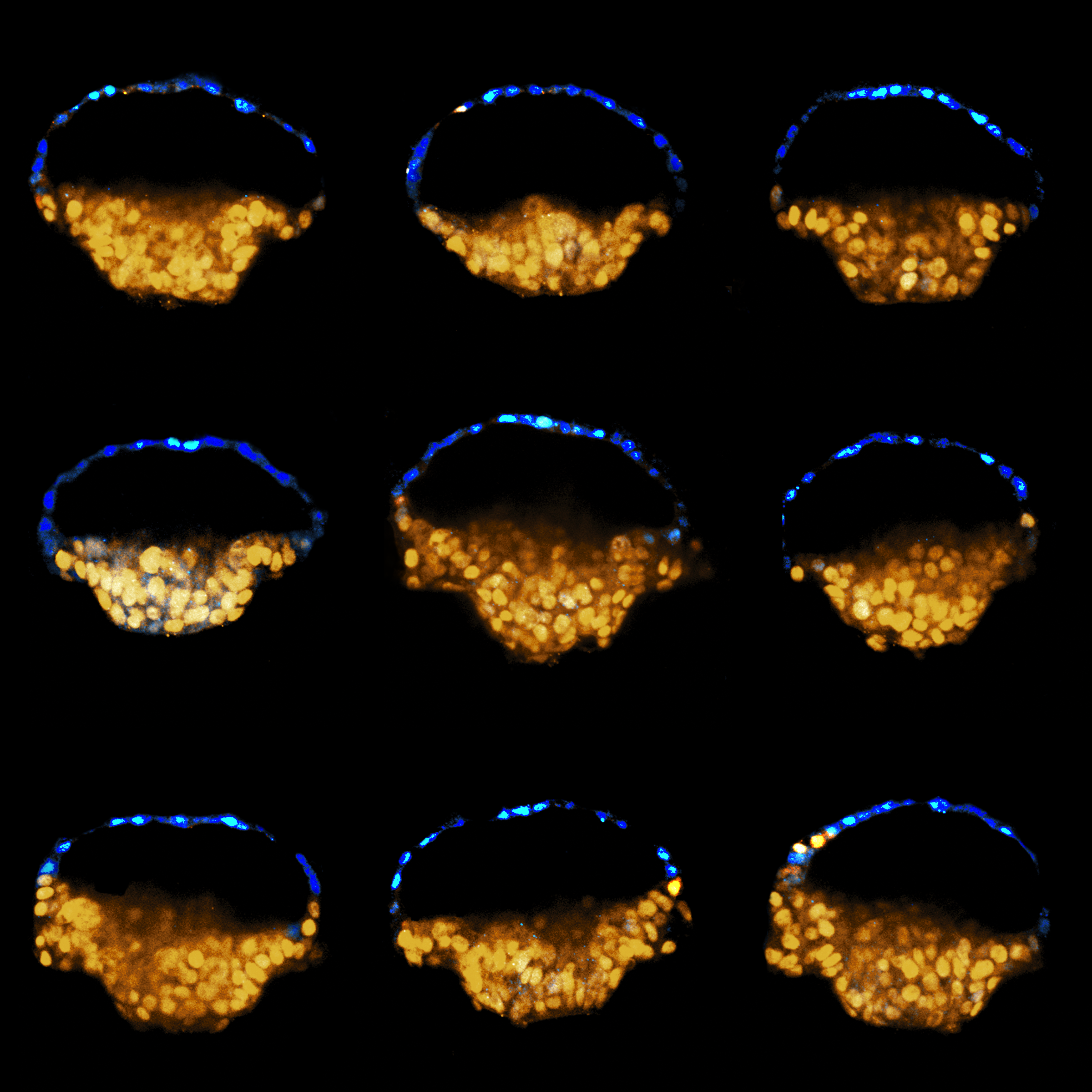 Controlled modelling of human epiblast and amnion development using stem cells