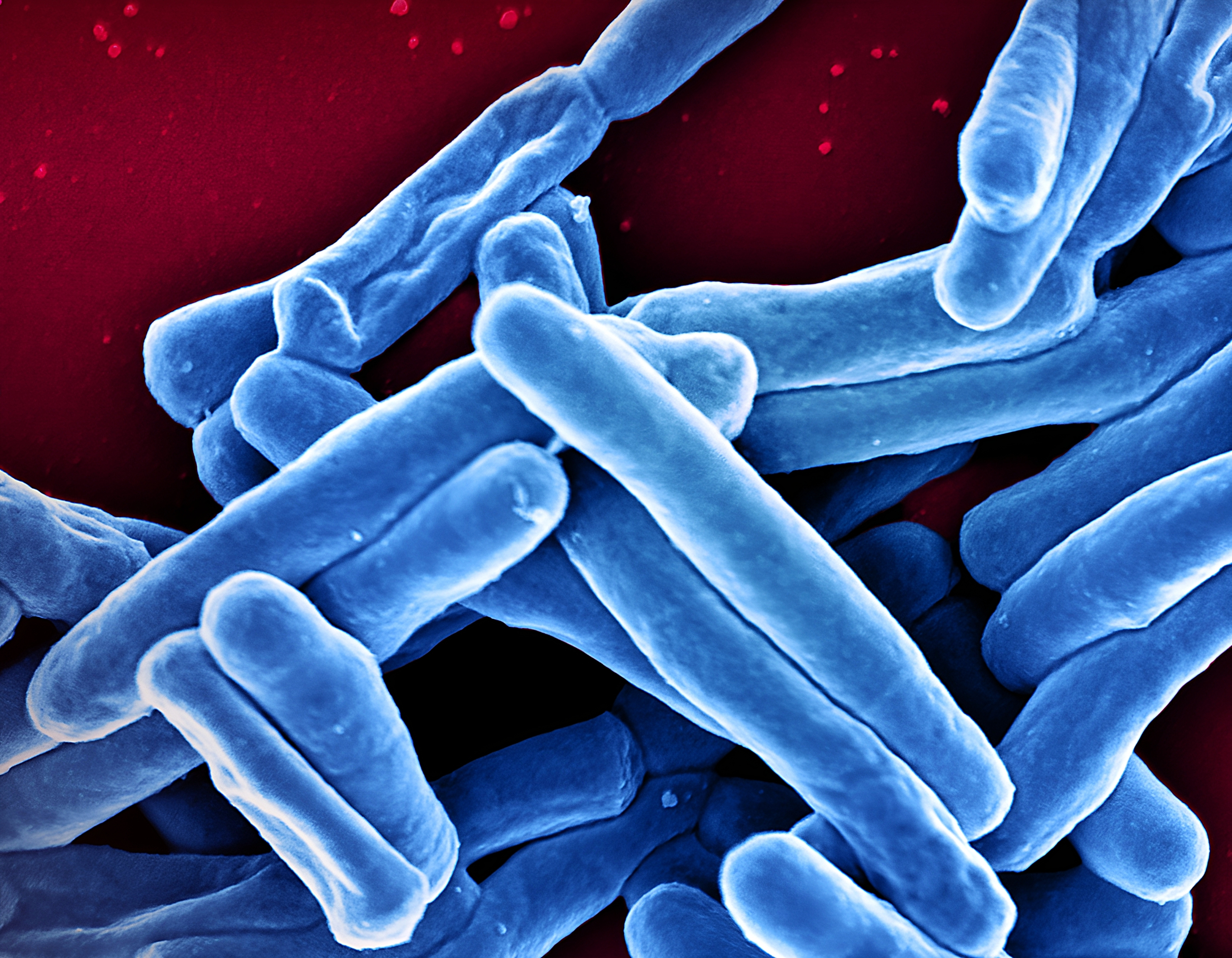BMC Infectious Diseases: Advancing Infectious Disease Research in Support of SDG 3
