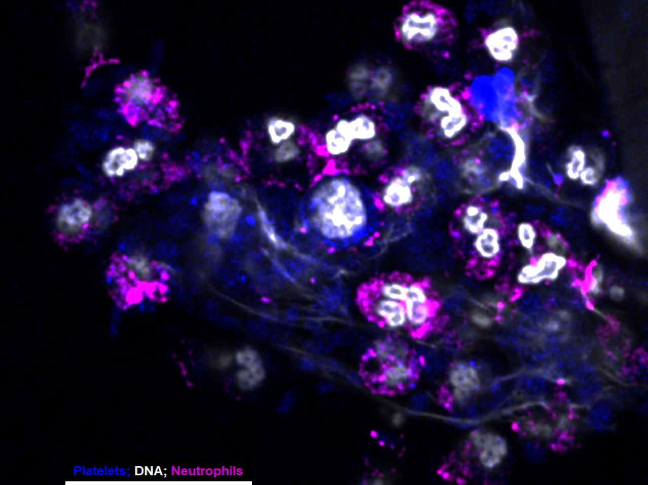 When Platelets meet Influenza: A Sticky Story 