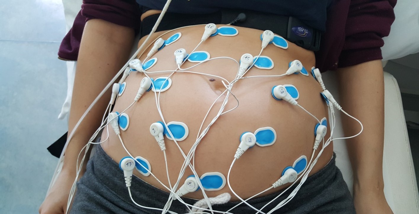 Non-invasive fetal electrocardiogram and Doppler in early pregnancy