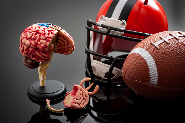 Athletic data depression: Gap in available neuroimaging data and technology limits understanding of effects of sports participation on the brain