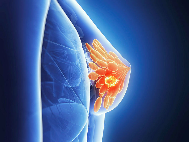 Editors' highlights: Breast Cancer Awareness Month