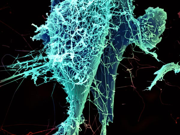 The Ebola Bundibugyo virus outbreak: clinical studies in progress