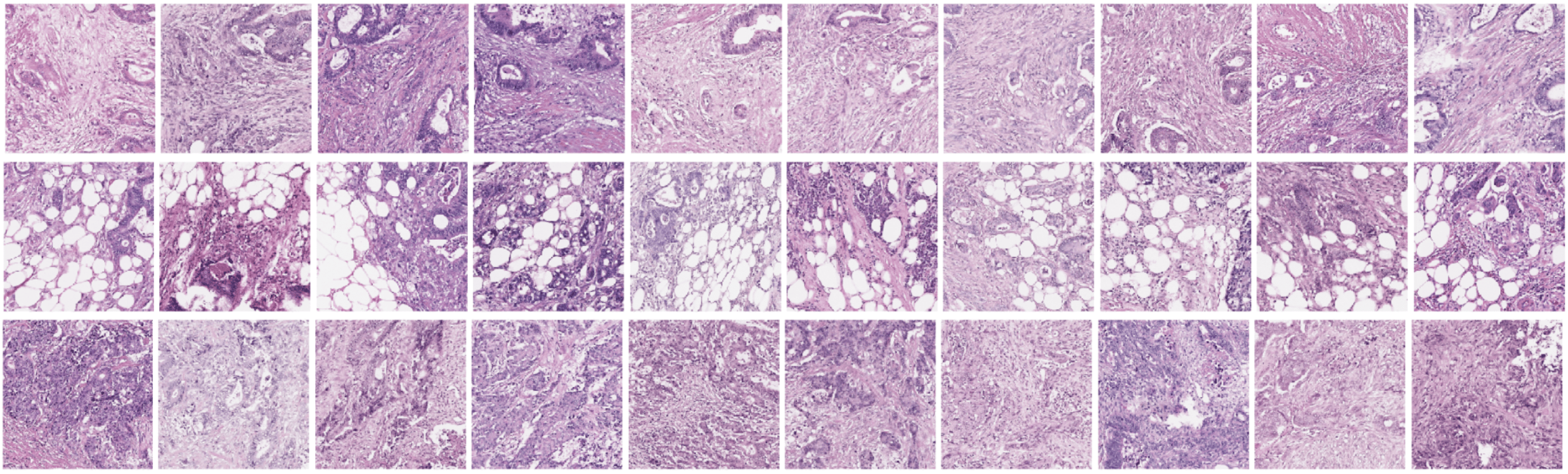 Learning from deep learning: developing interpretable AI approaches in histopathology to predict patient prognosis and explore novel features
