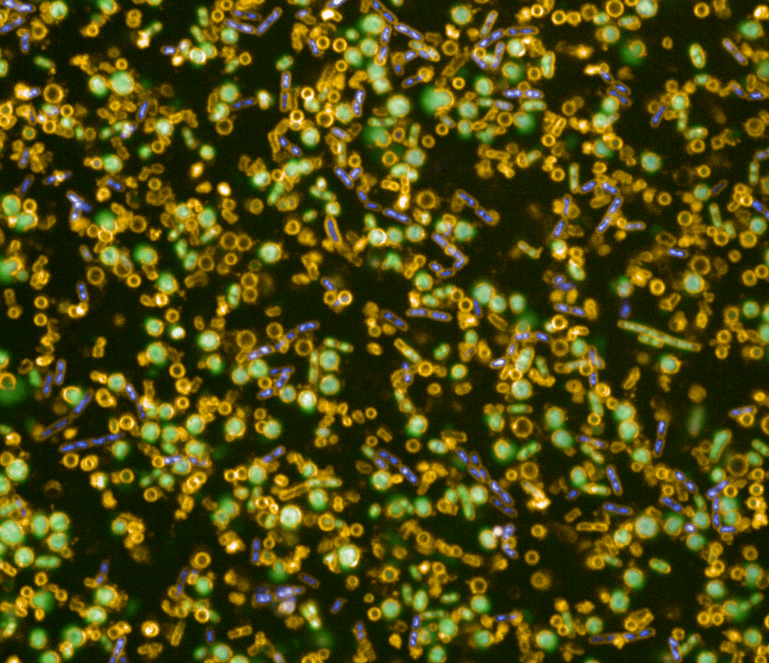 Linking bacterial antibody binding phenotypes to antibody function
