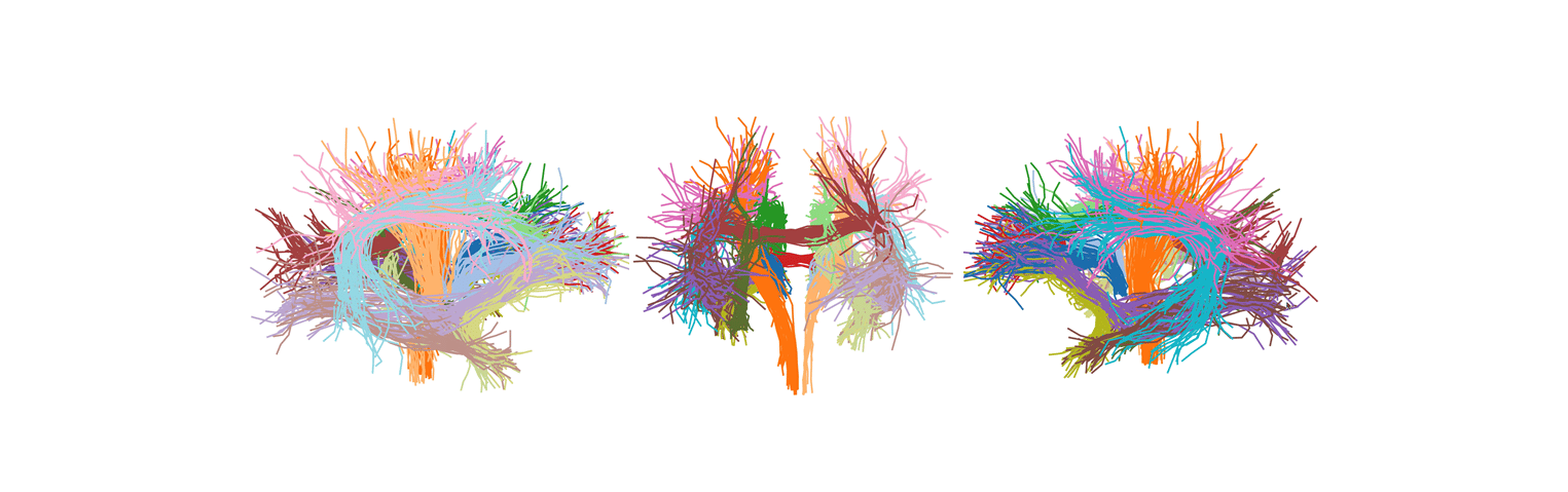 How the brains of newborns become wired up in just 6 months