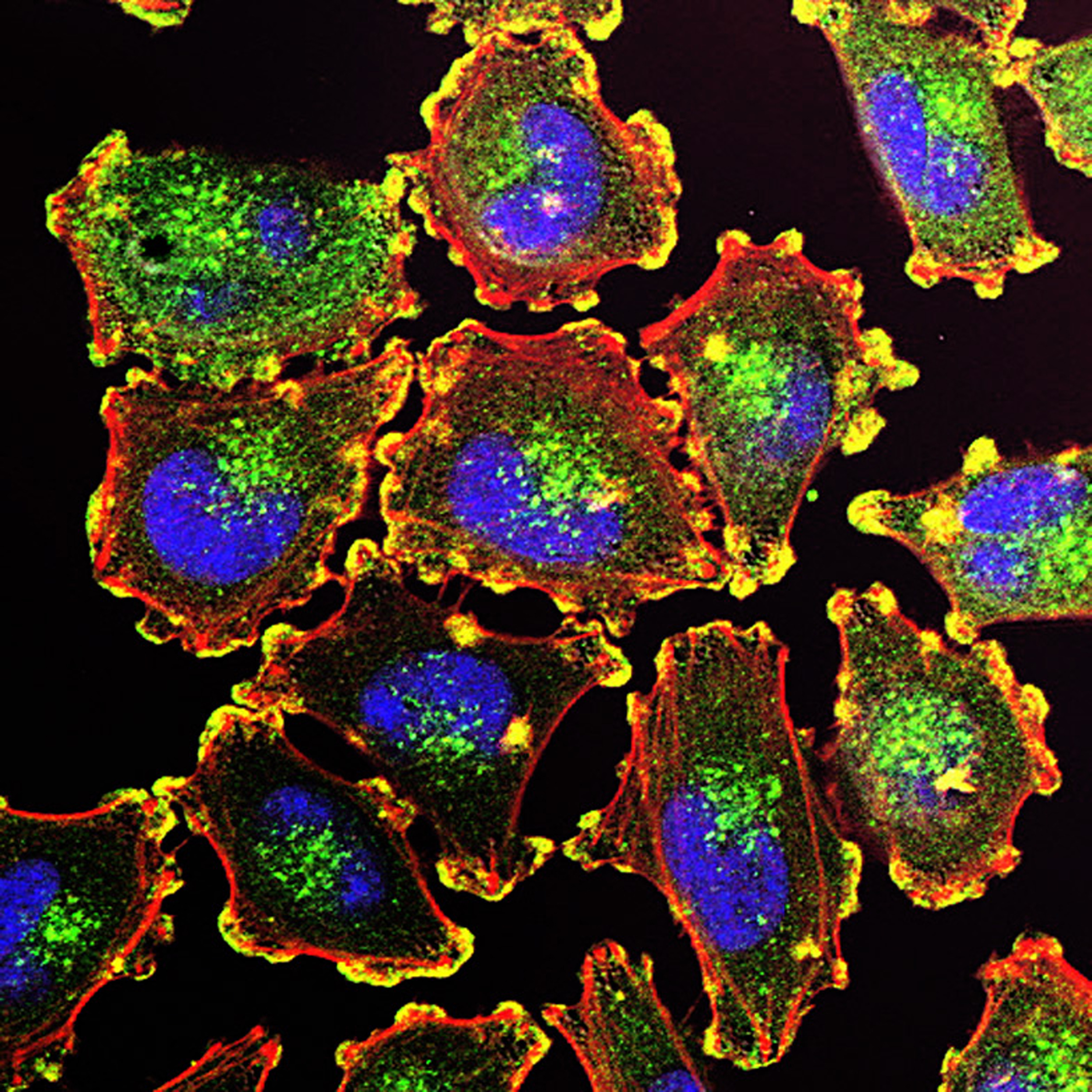 Simulated microgravity has anticancer effects