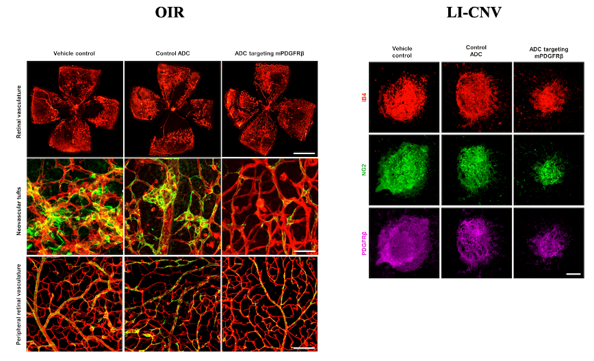Specific ablation of PDGFRβ-overexpressing pericytes with antibody-drug conjugate potently inhibits pathologic ocular neovascularization in mouse models