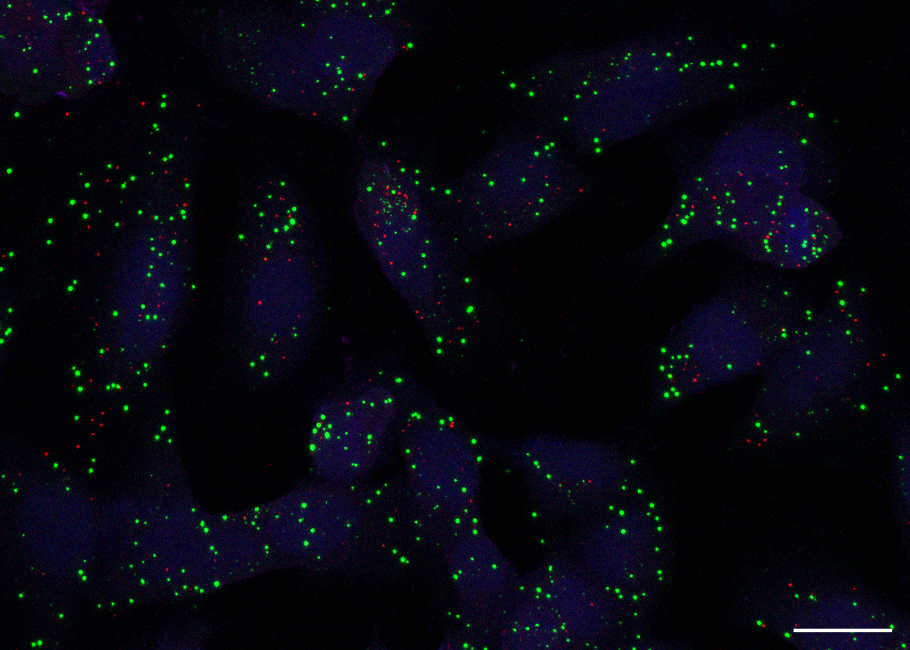 CDK12/13 inhibition overcomes platinum resistance by impairing RNA metabolism