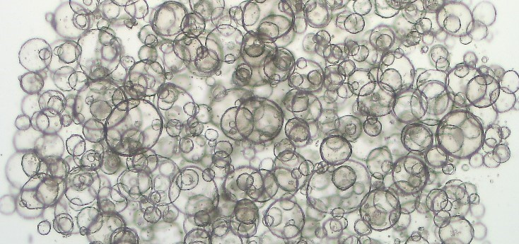 Can organoids revolutionize personalized treatment in cancer patients?