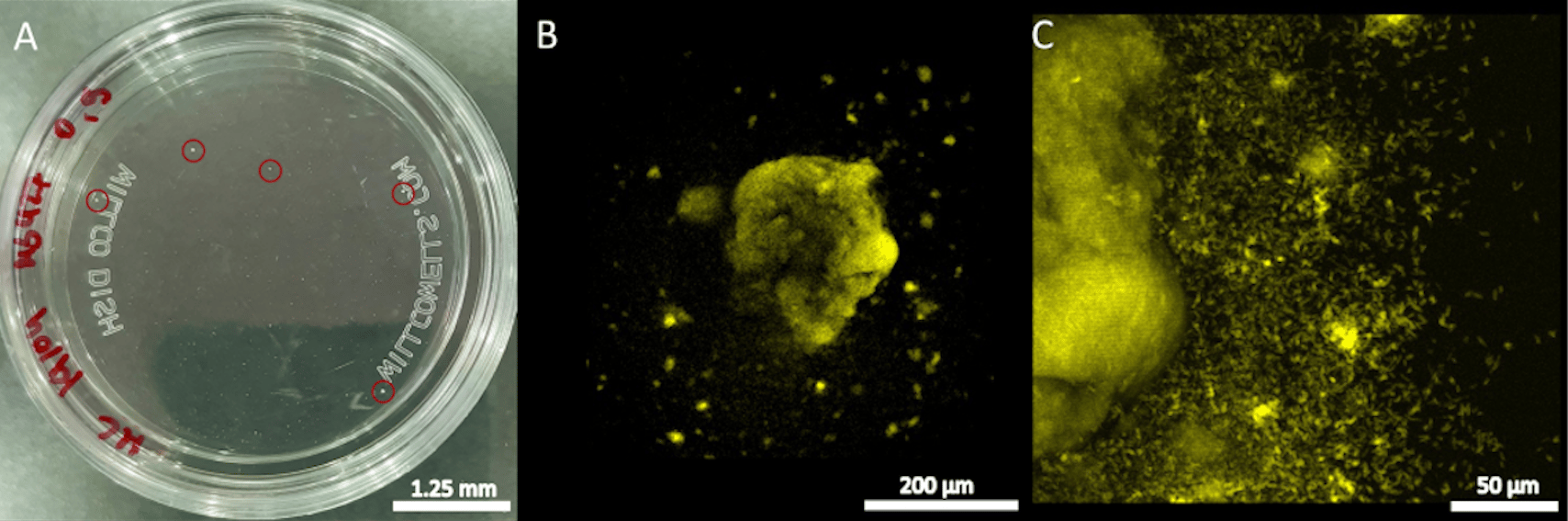 Motility speeds up bacterial invasion