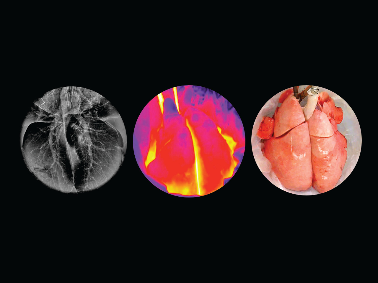 Recovering injured lungs with cross-circulation