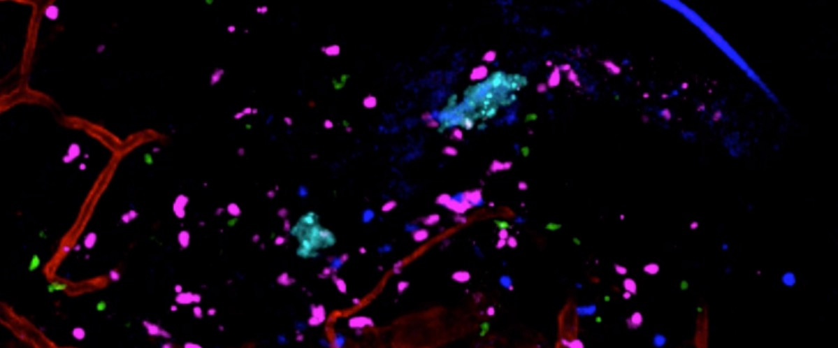 Does the canonical model give a complete picture of the innate immune response to bacterial invasion?