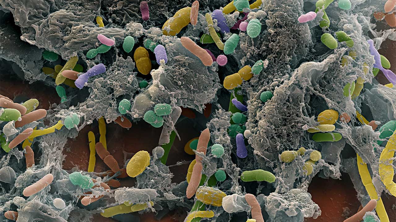 Ecological theory coming to a gut near you