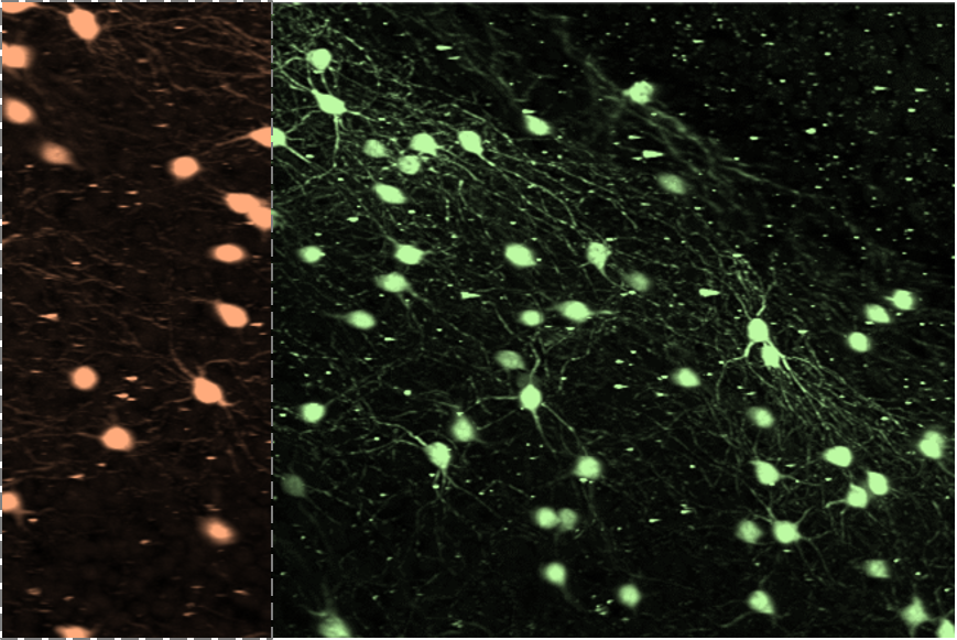 Incorporating the image formation process into deep learning improves network performance