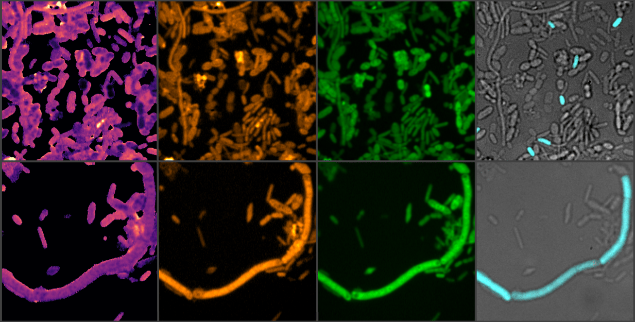 Beyond the target: how a Parkinson's drug doubles up as an inducer of microbial iron starvation