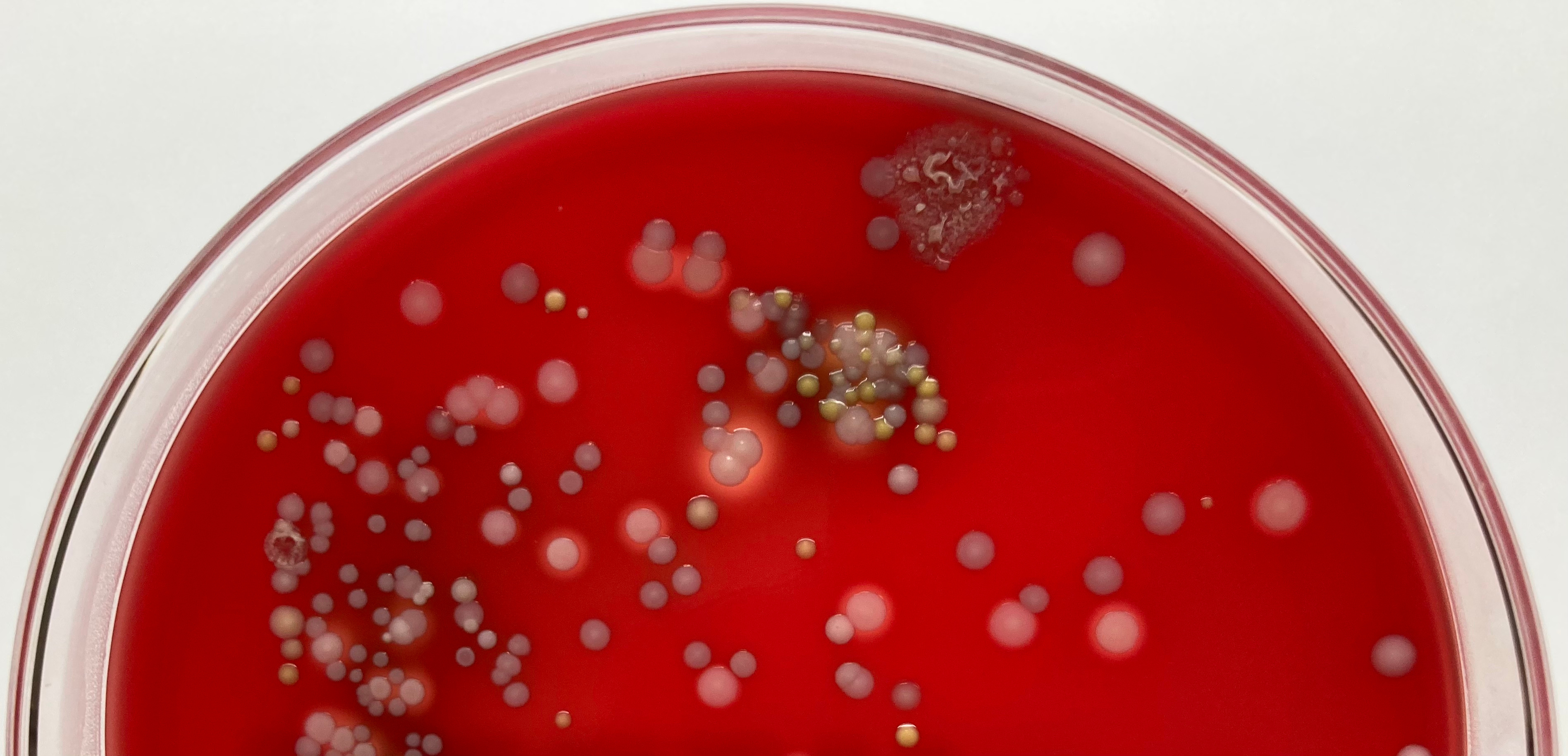 Pervasive horizontal gene transfer in coagulase-negative Staphylococcus