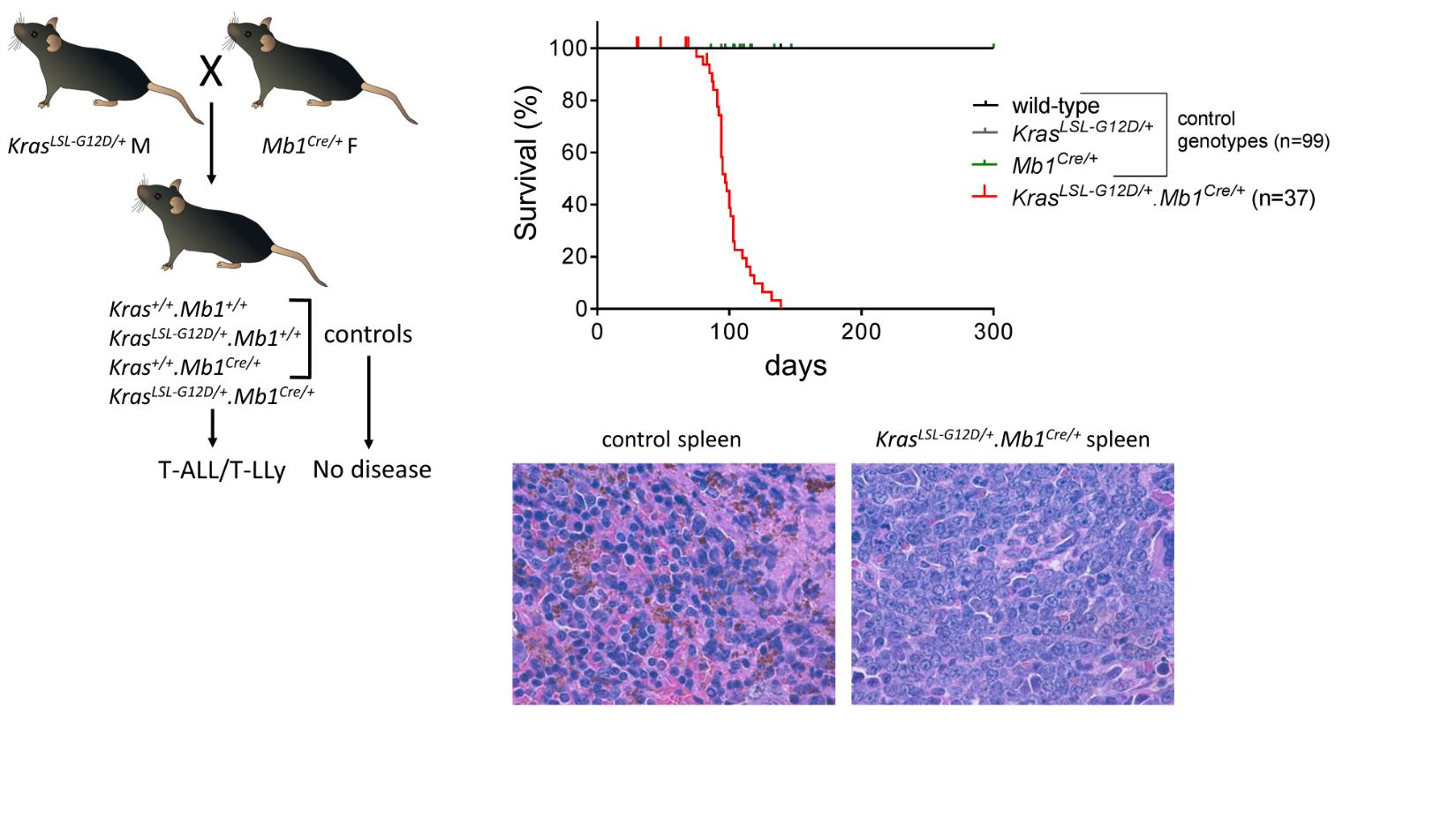 A new mouse model of Kras mutation-driven T-ALL