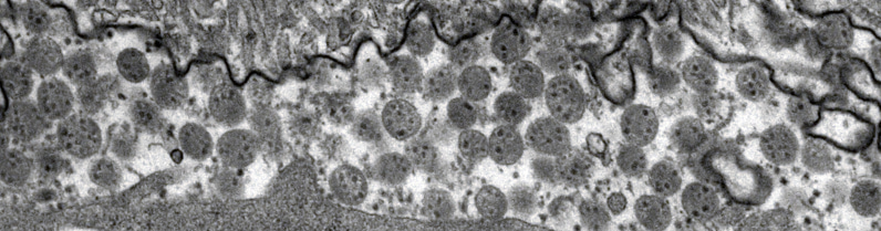 Genomes of parasitic wasps sheds light on the evolution of viral domestication