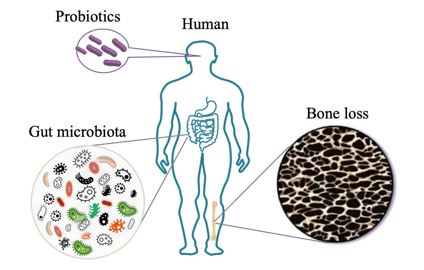 A challenging journey of exploring the probiotic effect on bone metabolism of the elderly