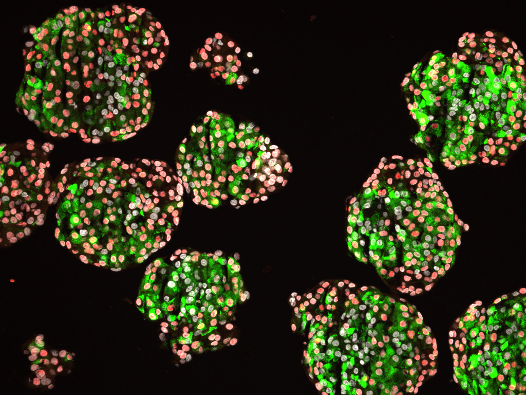 Controlling the microenvironment to make β cells from human stem cells for diabetes regenerative therapy