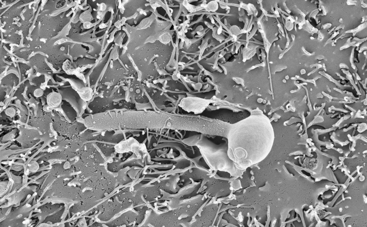 Zooming into the most recent evolution of yeast pathogens