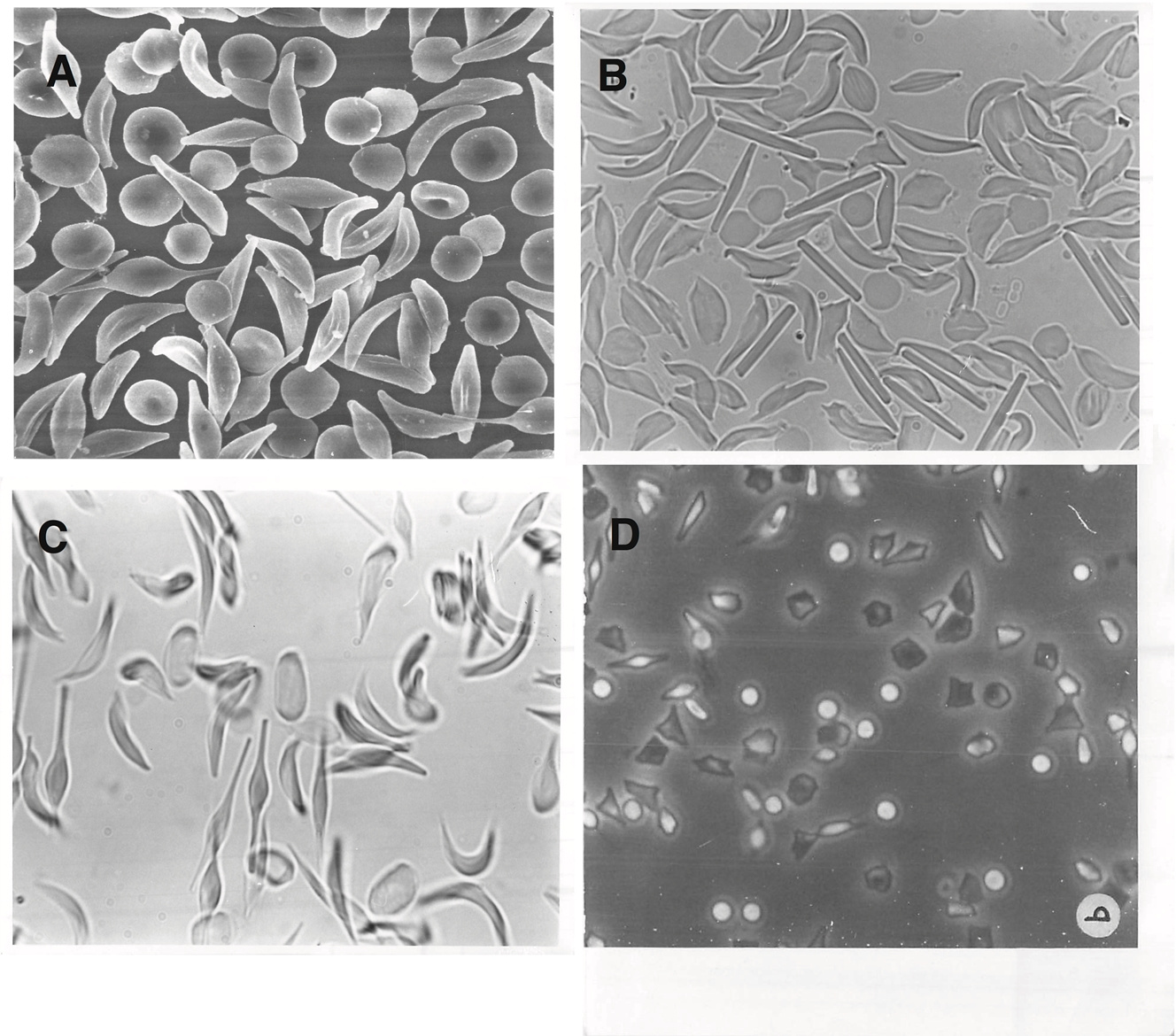 A bloody tale - sickle cells in deer 