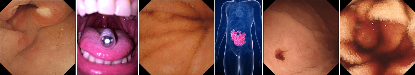 Kvasir-Capsule: A dataset for next-level capsule endoscopy AI methods