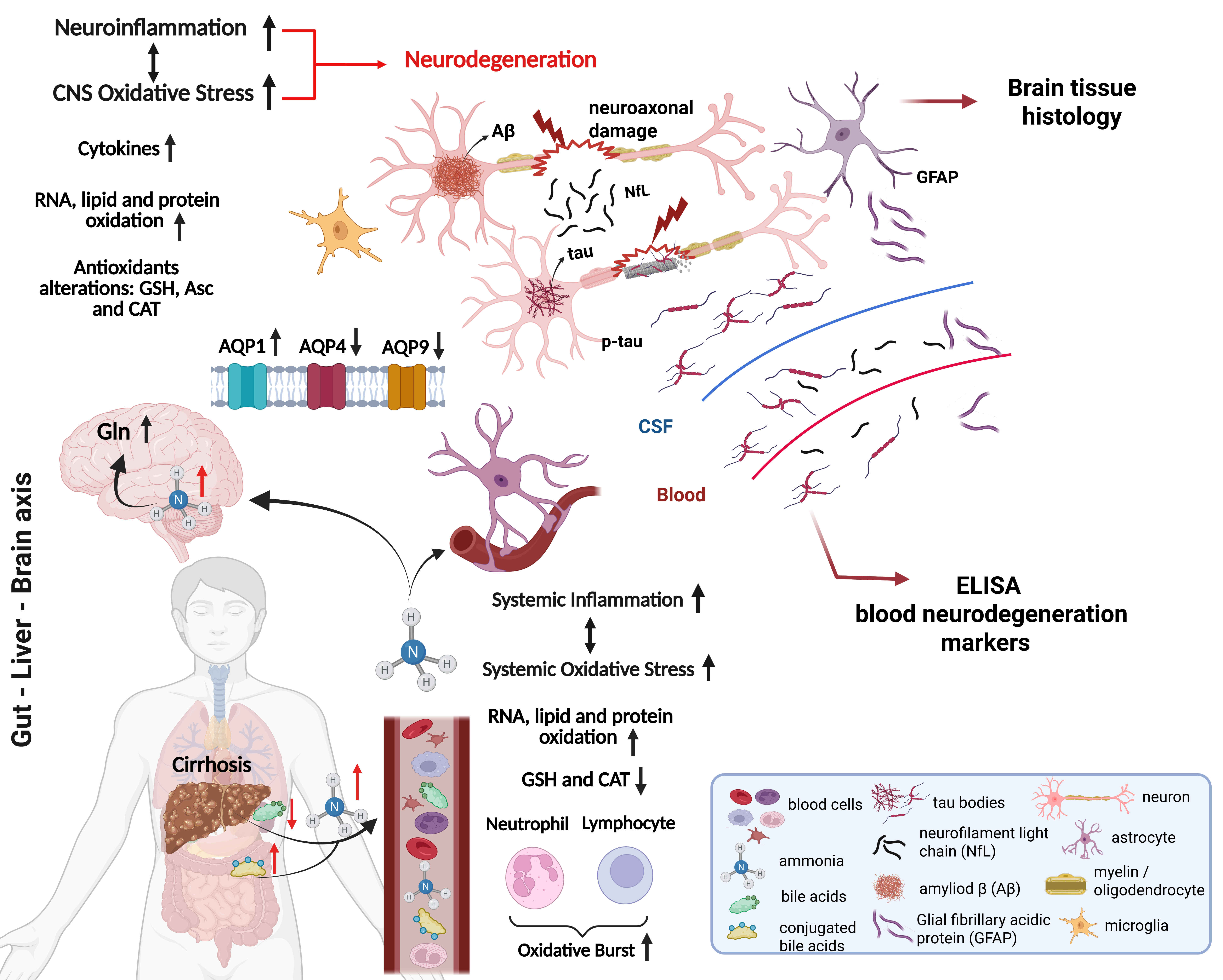 Liver dysfunction triggers early Alzheimer’s pathology in an adult rat model of chronic liver disease
