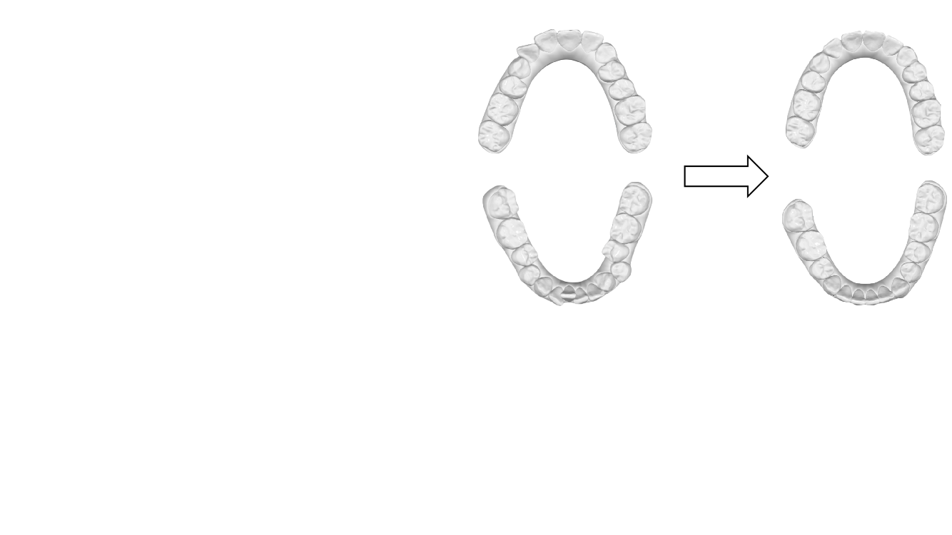 A 3D dental model dataset with pre/post-orthodontic treatment for automatic tooth alignment