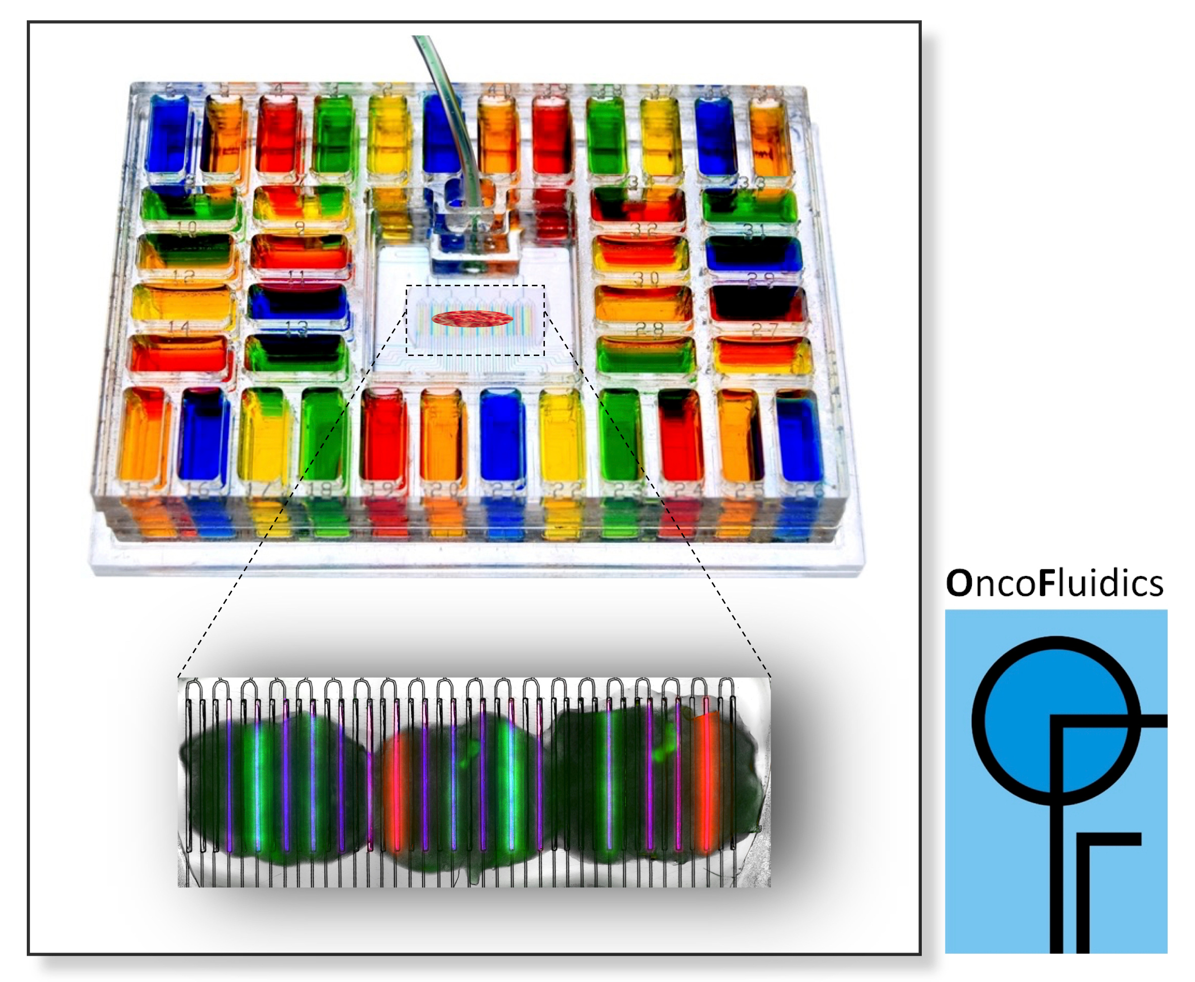 A marriage of tumor slices and microfluidics