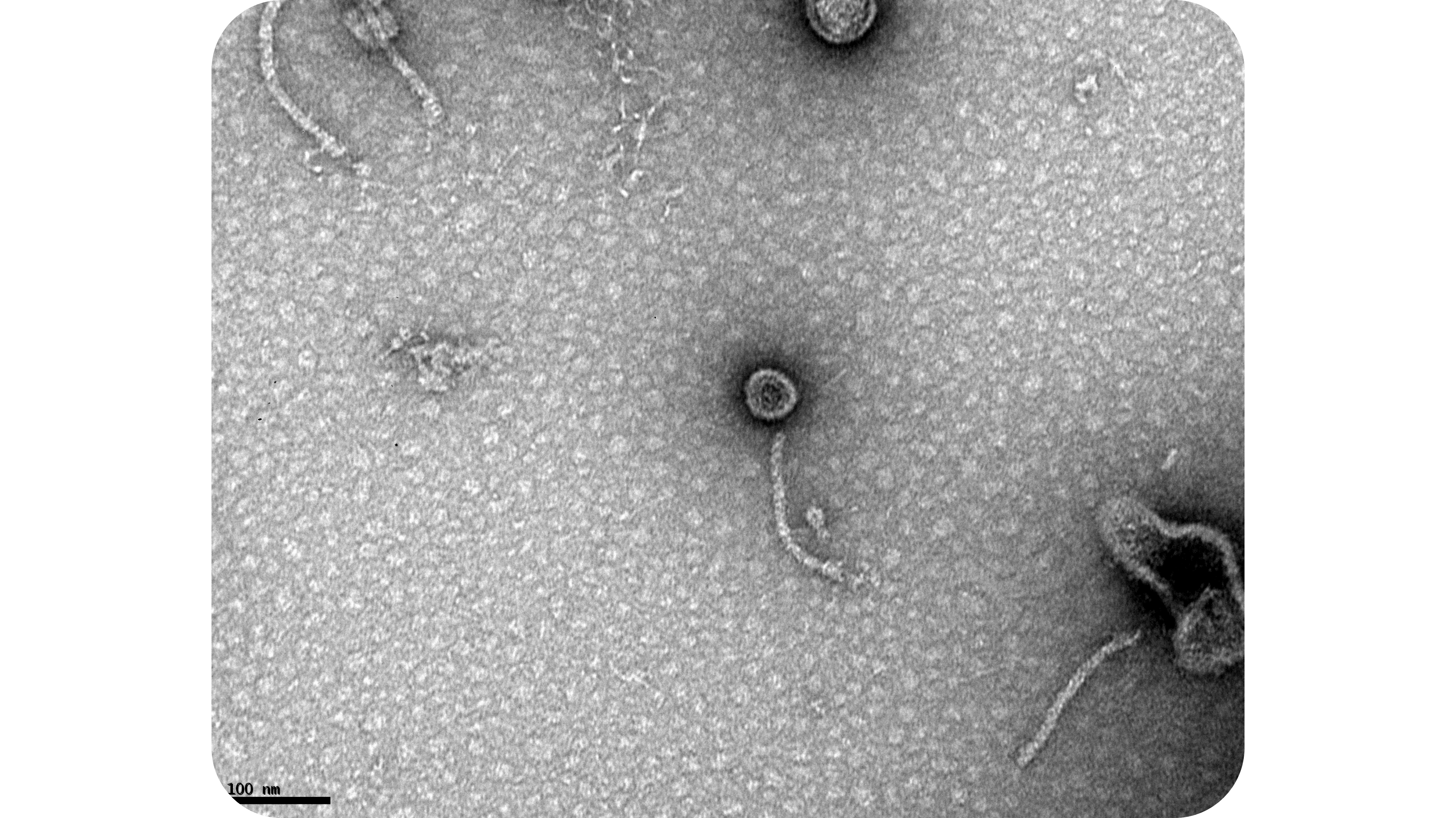 Are in vitro fermentation models good to study phages safety towards the colonic microbiota? 