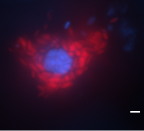 The story of  the enigmatic sponge symbionts Candidatus Nemesobacterales