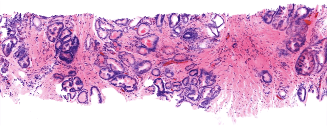 Transforming clinical pathology with light-sheet microscopy