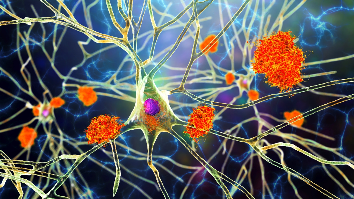 Call for papers: Brain metabolomics in dementia and neurological disease Collection