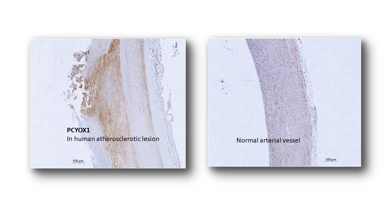 Prenylcysteine oxidase 1, an emerging player in atherosclerosis