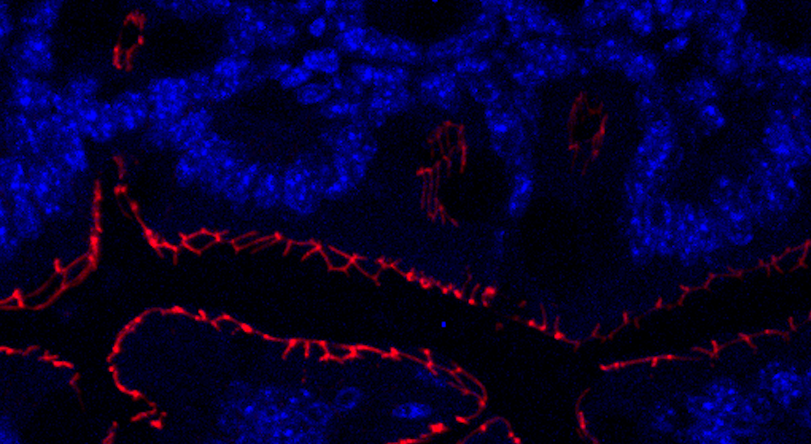 Behind the Paper: The Art of Losing - How Loss of Immunosuppressive Bacteria Shapes Immunotherapy Response 