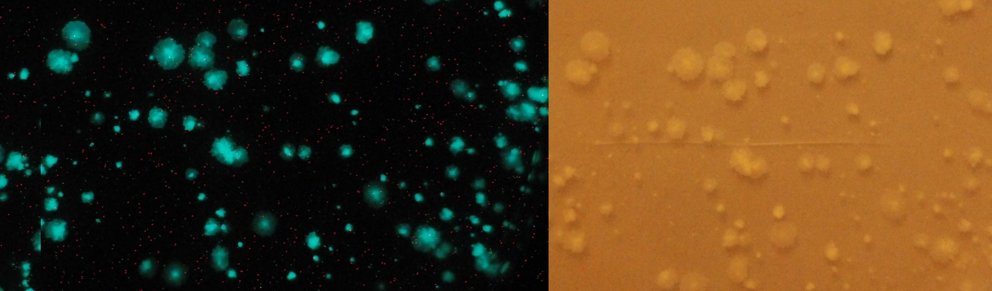 The Achilles' Heel Targeted by TB47 Is Protected in Select Mycobacteria. 
