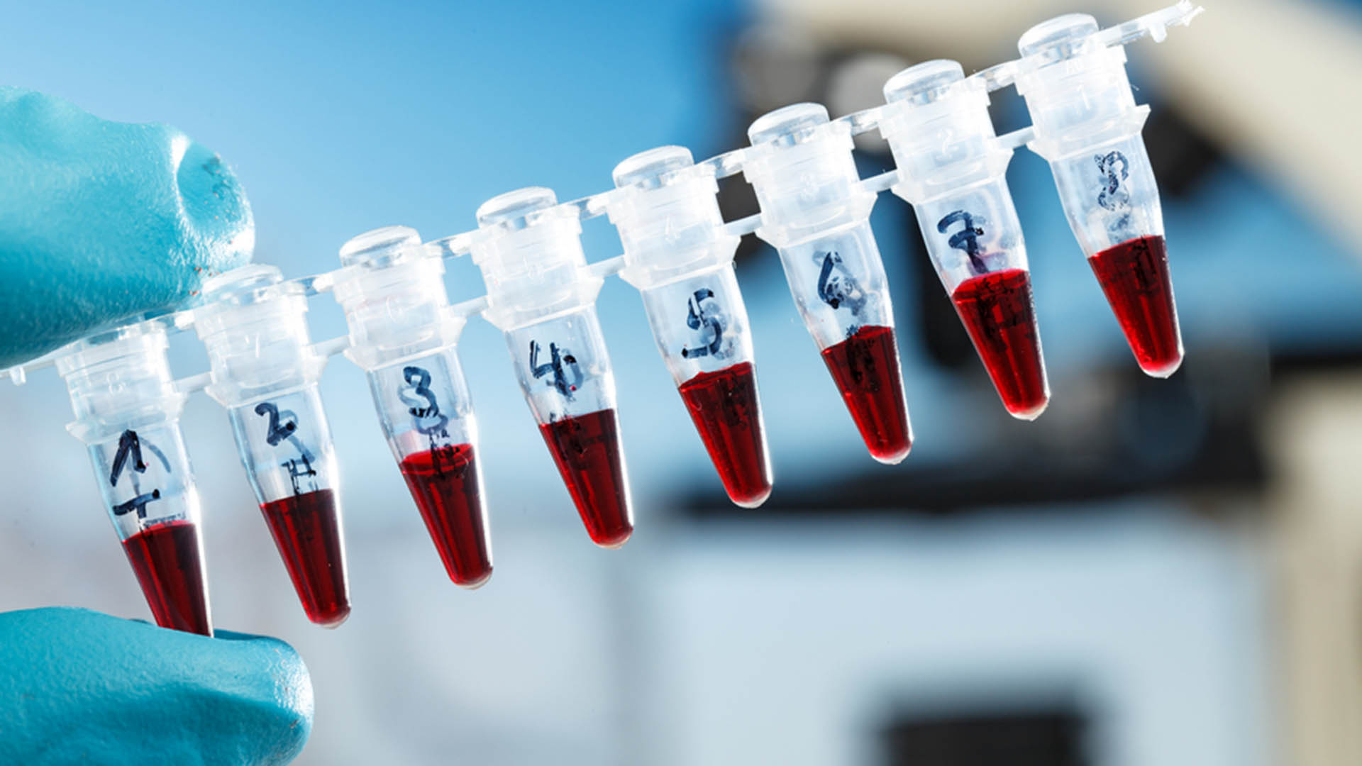 Diagnosis of Coronavirus-Protocol Overviews