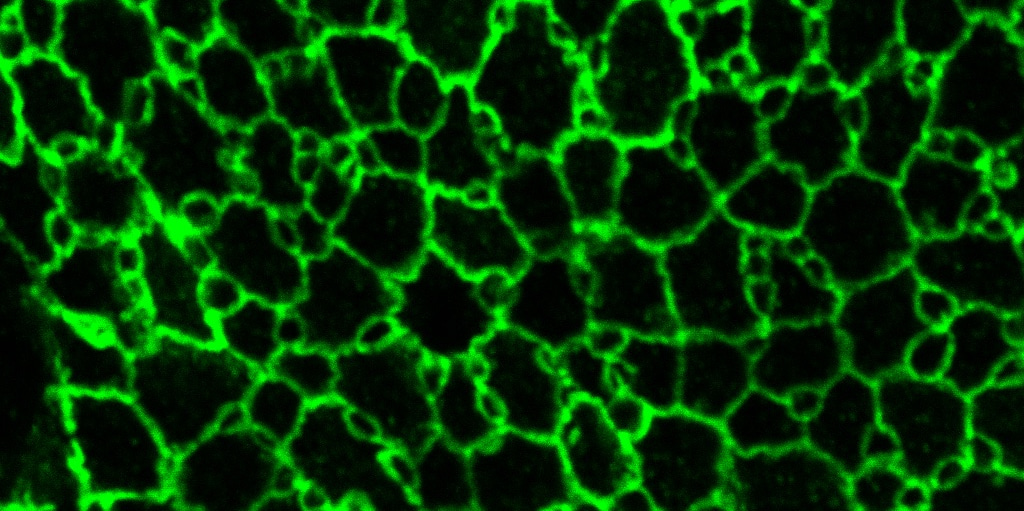 Capturing cellular rearrangements in developing sensory epithelia