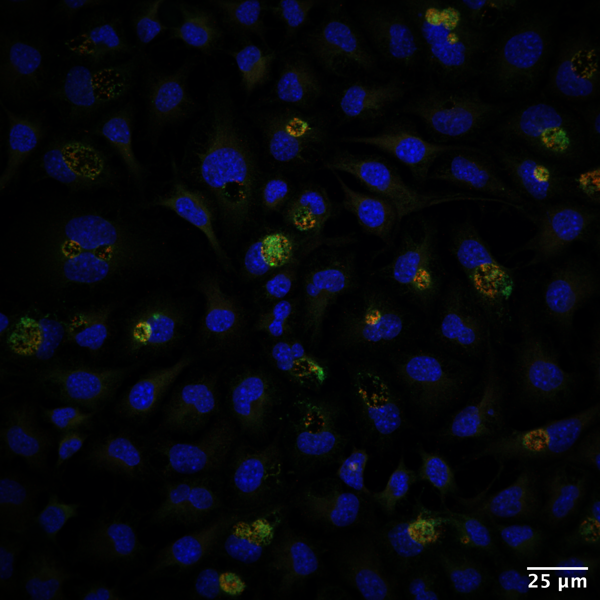 Atypical attenuation